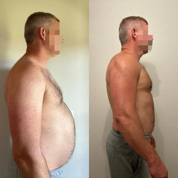 Antes e depois de cliente OzCaps