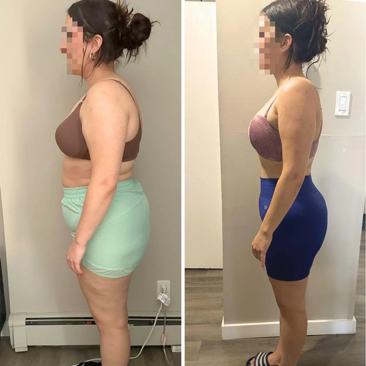 Antes e depois de cliente OzCaps