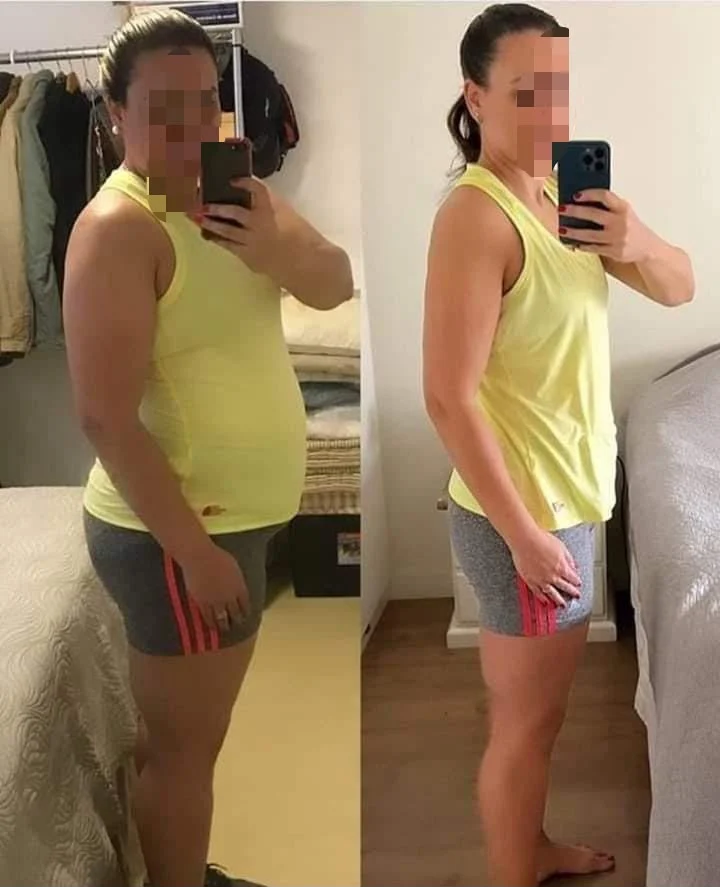 Antes e depois de cliente OzCaps